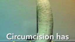 Should Circumcision be Banned?